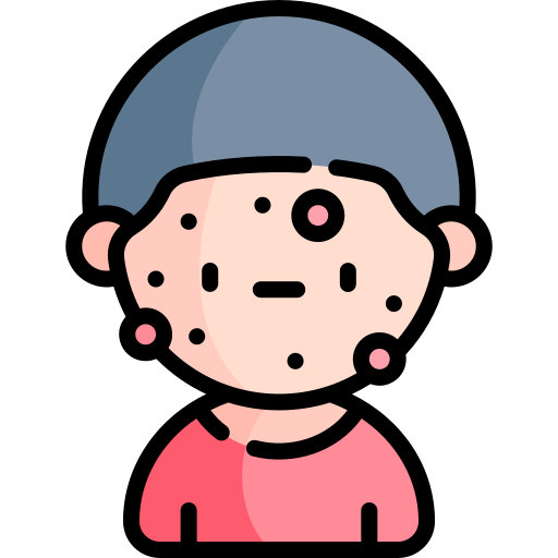 allergy