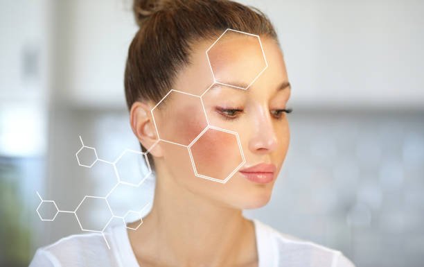 dark spots, freckles,hyperpigmentation(melasma or chloasma)