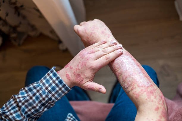 adult skin problem