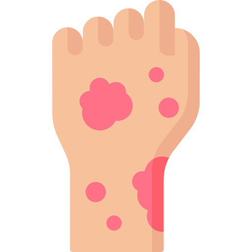 rash